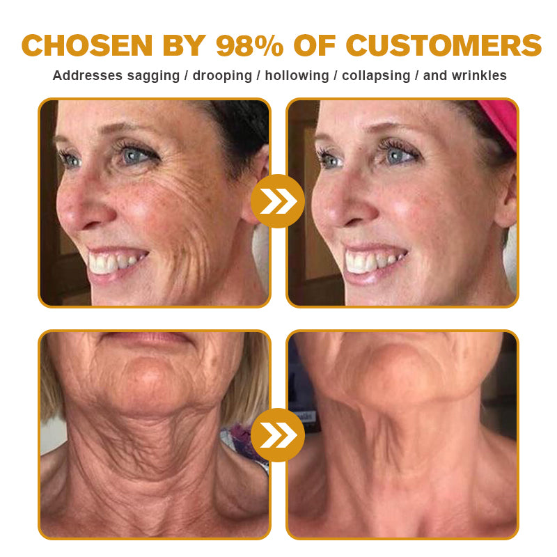 (Made and Shipped from USA ) ✨TLOPA® Botox Bee Venom Wrinkle Removal Cream- LAST DAY 70% OFF 🌹