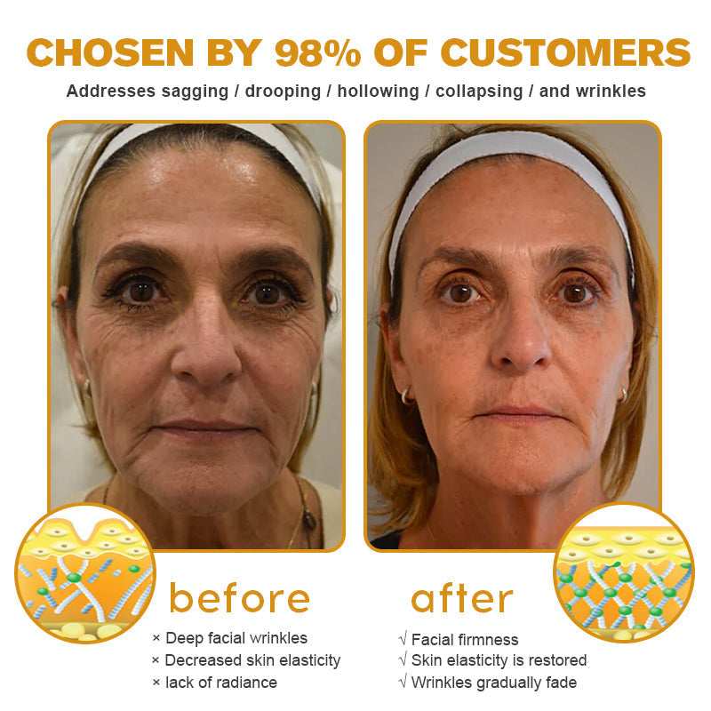 (Made and Shipped from USA ) ✨TLOPA® Botox Bee Venom Wrinkle Removal Cream- LAST DAY 70% OFF 🌹