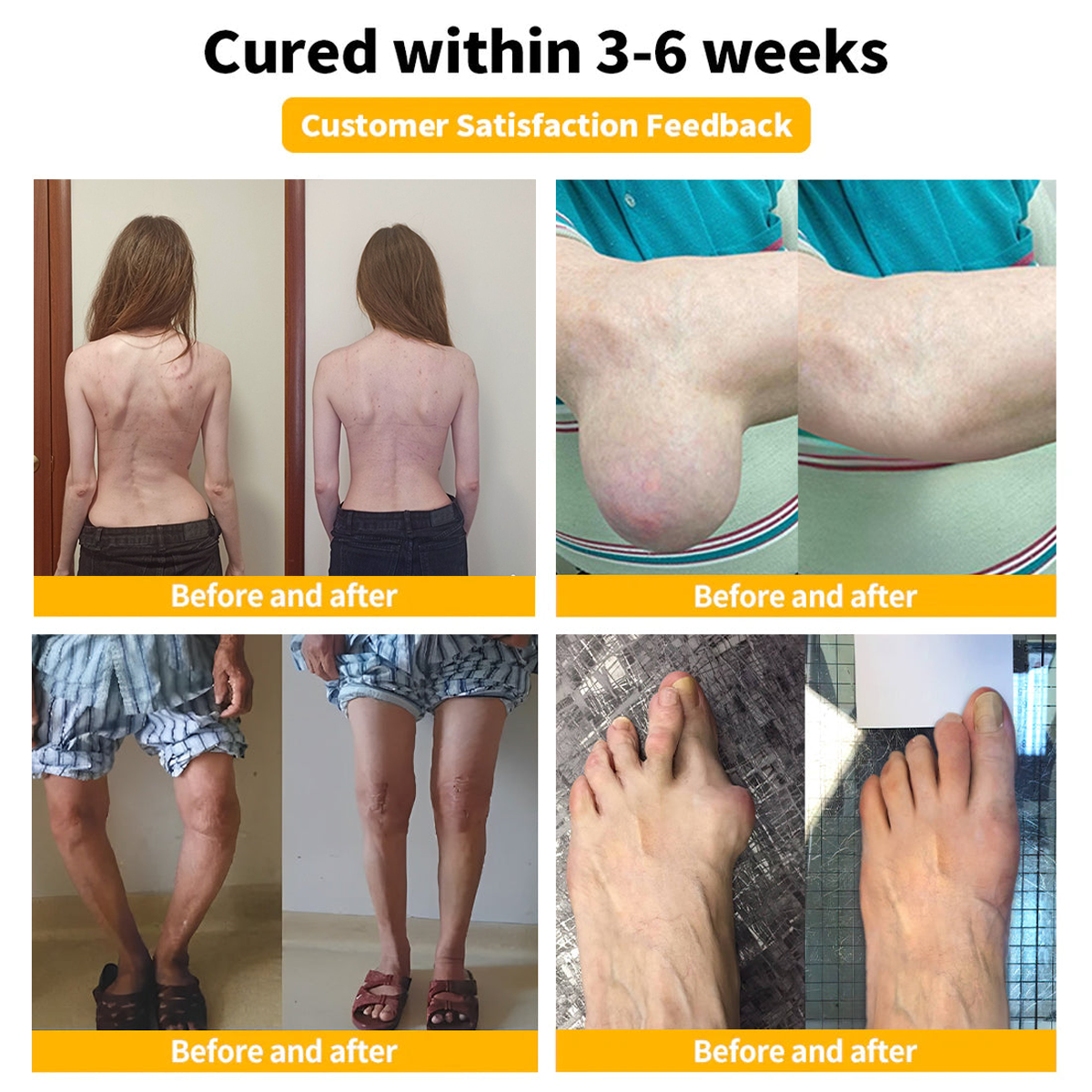 Official Store: TLOPA® Bee-Venom Pain-Relief Bone Healing Cream (Reducing joint swelling, pain, stiffness, redness, warmth, soreness, and joint fatigue)