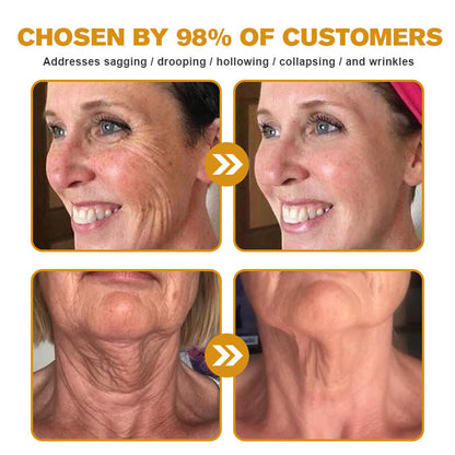 (Made and Shipped from USA ) ✨TLOPA® Botox Bee Venom Wrinkle Removal Cream- LAST DAY 70% OFF 🌹