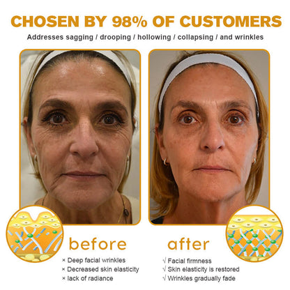 (Made and Shipped from USA ) ✨TLOPA® Botox Bee Venom Wrinkle Removal Cream- LAST DAY 70% OFF 🌹